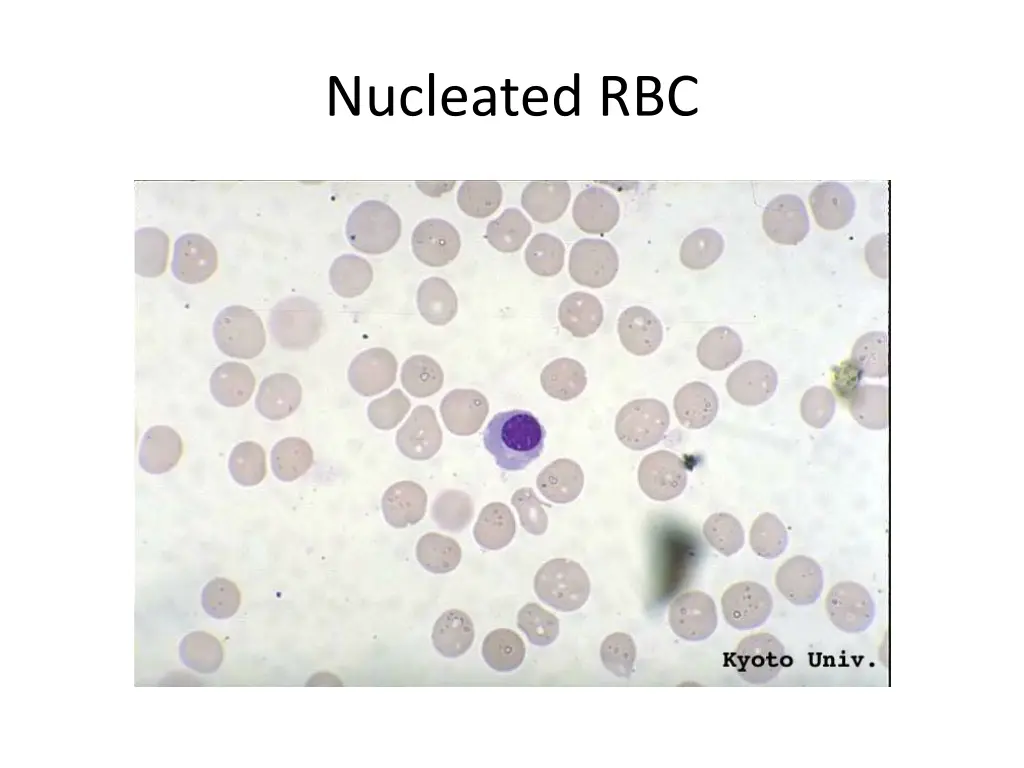 nucleated rbc