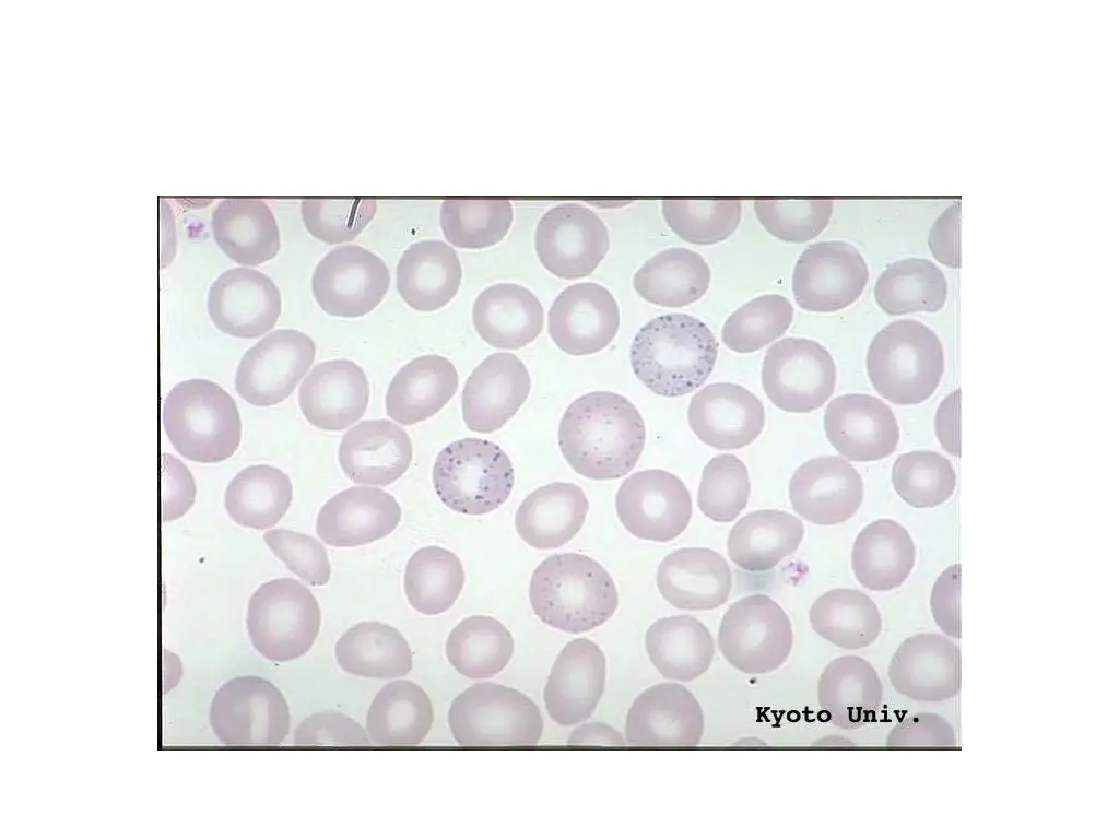 slide21