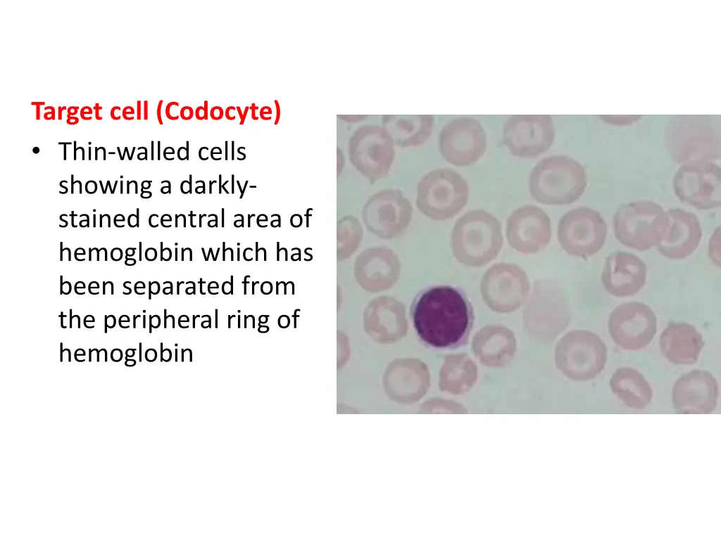 target cell codocyte thin walled cells showing