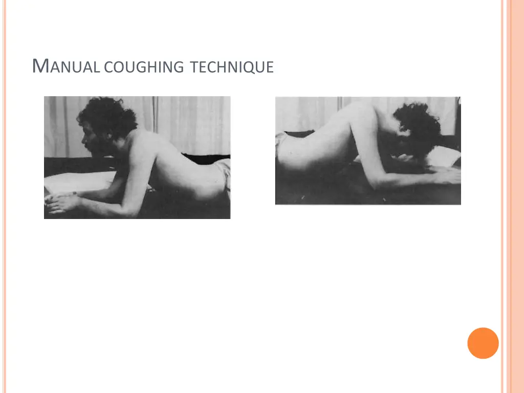 m anual coughing technique
