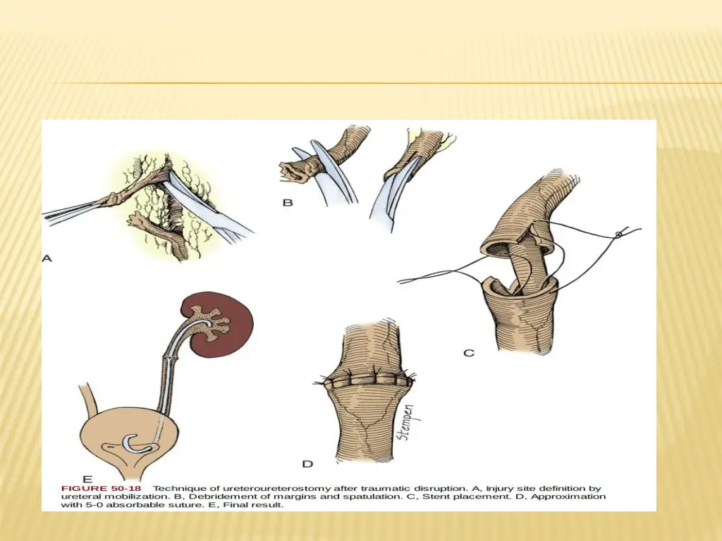 slide39