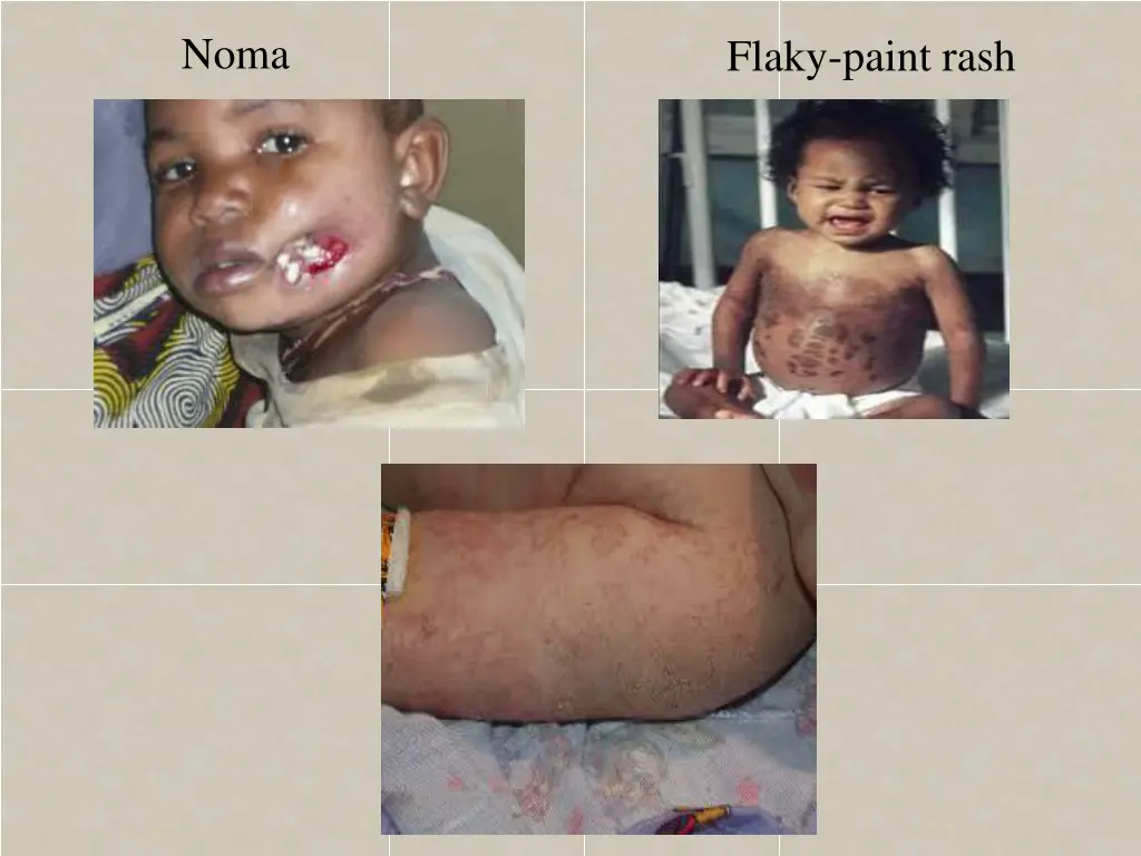 slide23