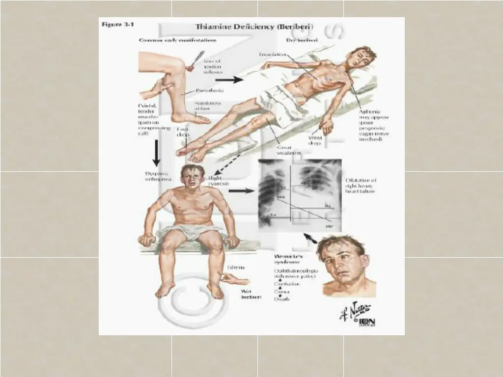 slide28