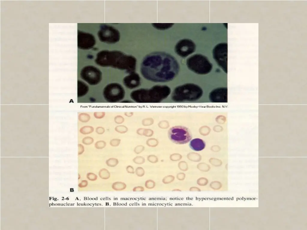 slide37