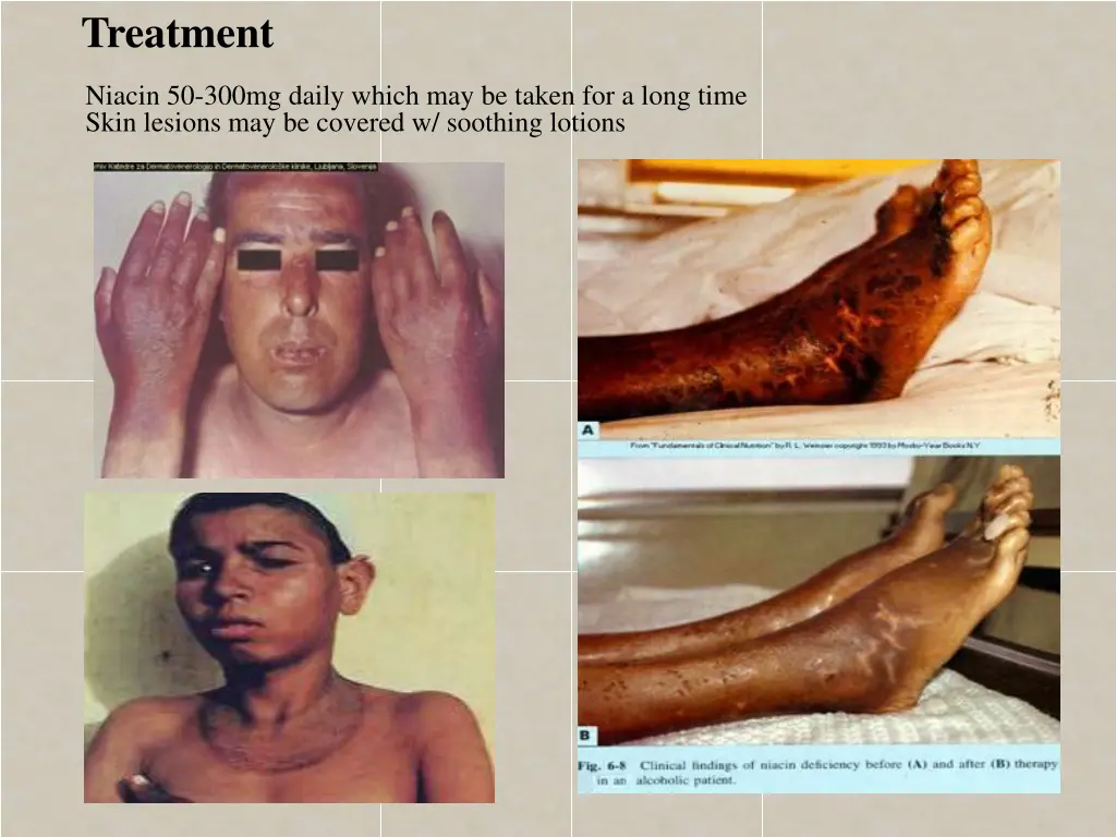 treatment