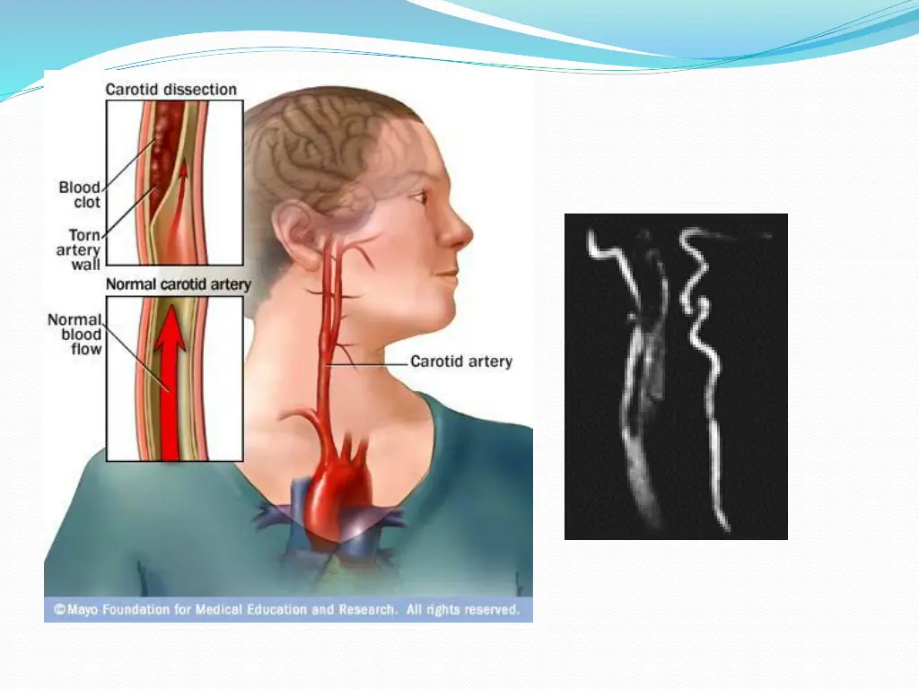 slide40
