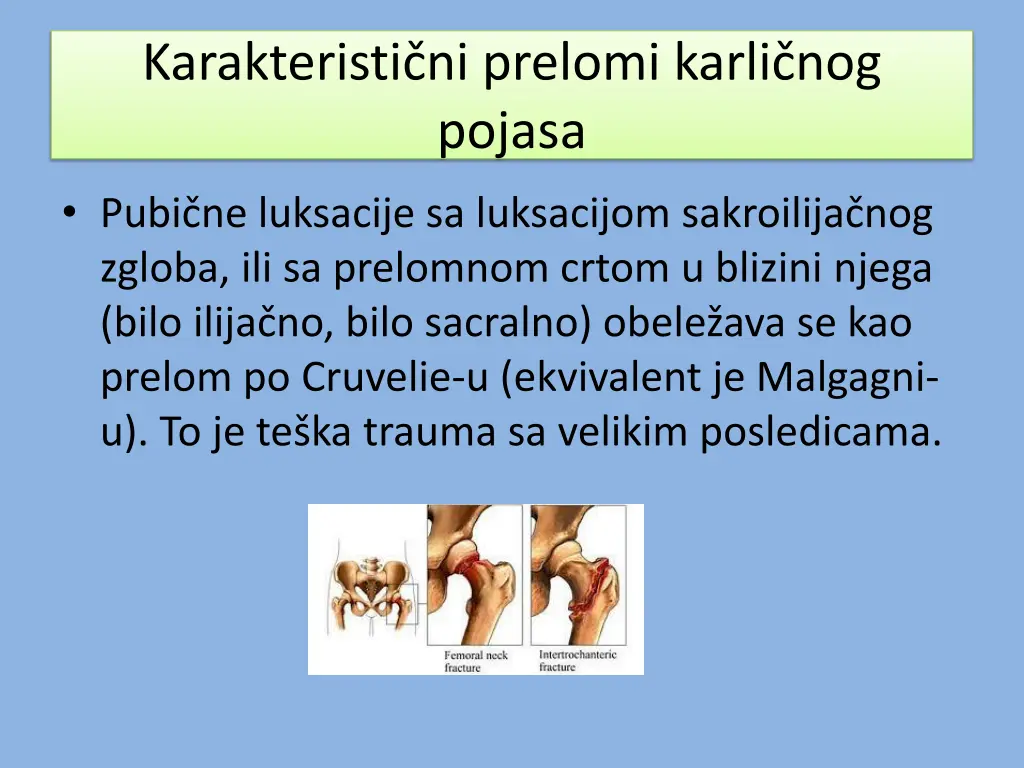 karakteristi ni prelomi karli nog pojasa 2