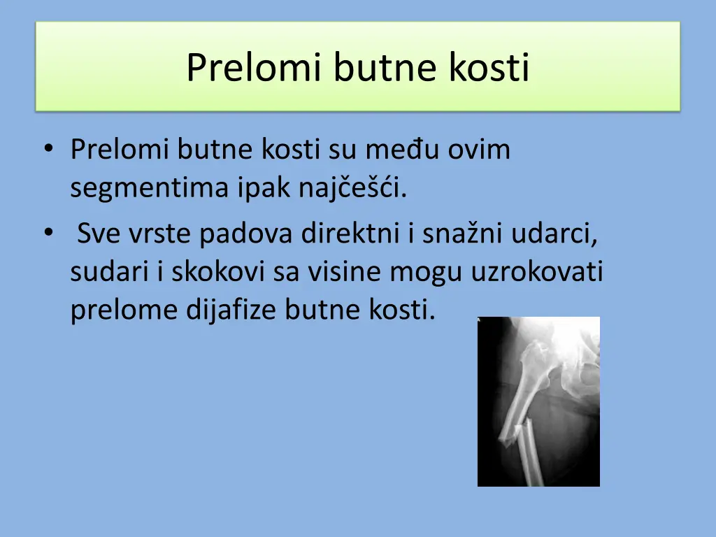 prelomi butne kosti