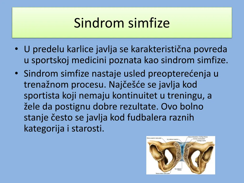 sindrom simfize