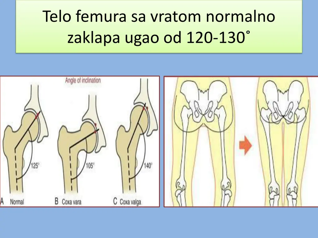 telo femura sa vratom normalno zaklapa ugao