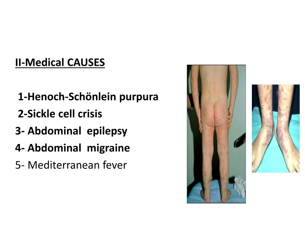 ii medical causes 1 henoch sch nlein purpura