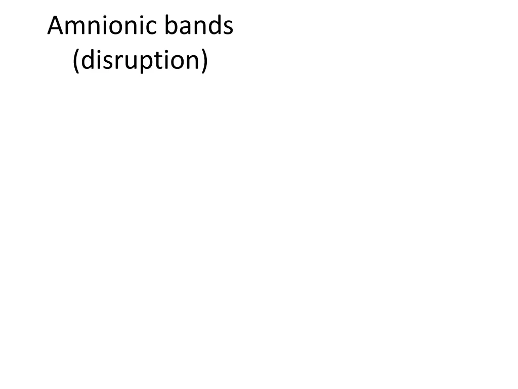 amnionic bands disruption