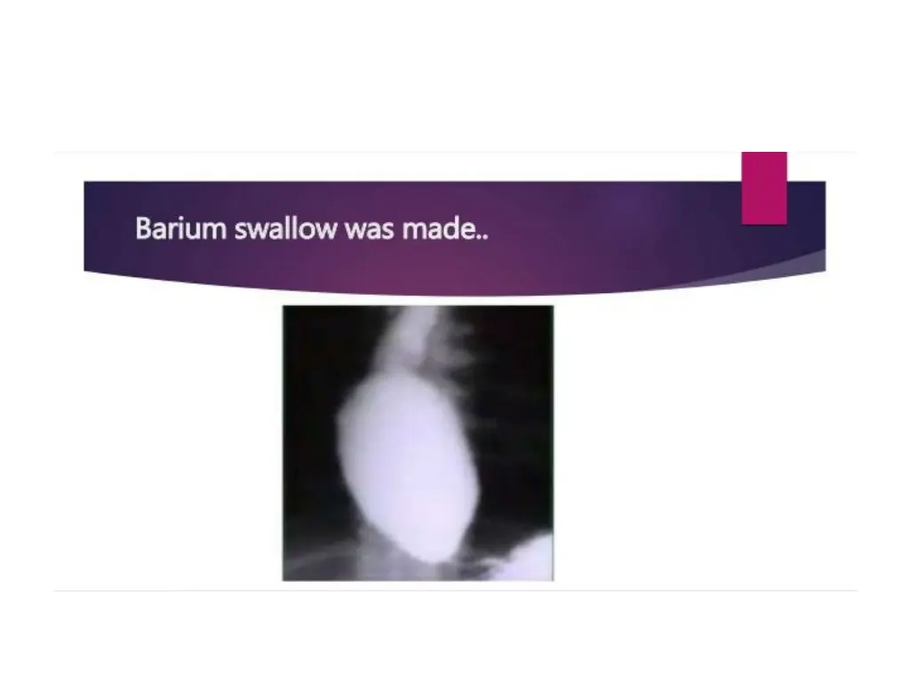 slide4