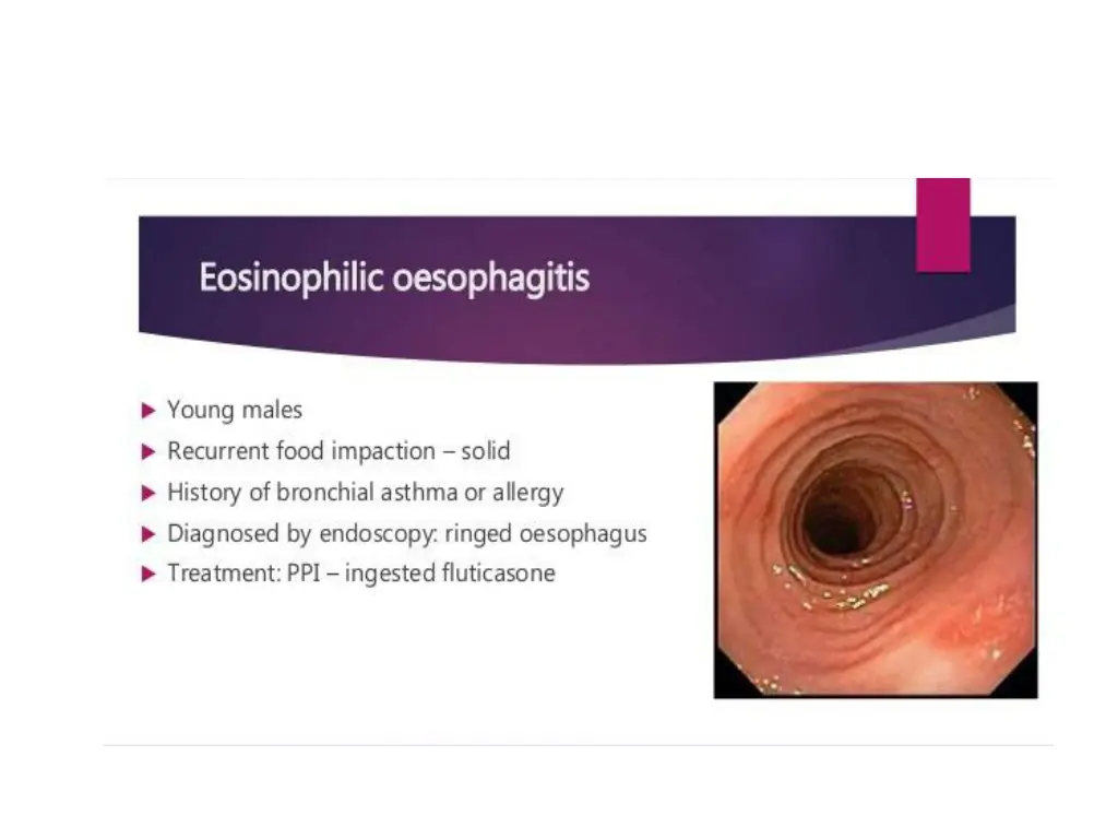 slide7