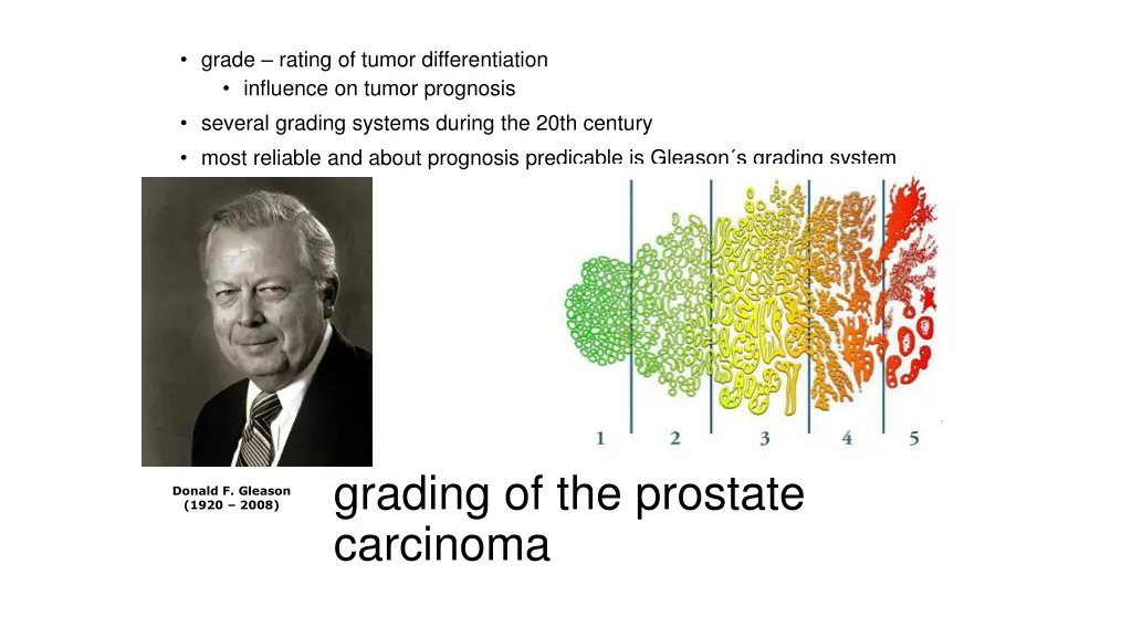 grade rating of tumor differentiation influence