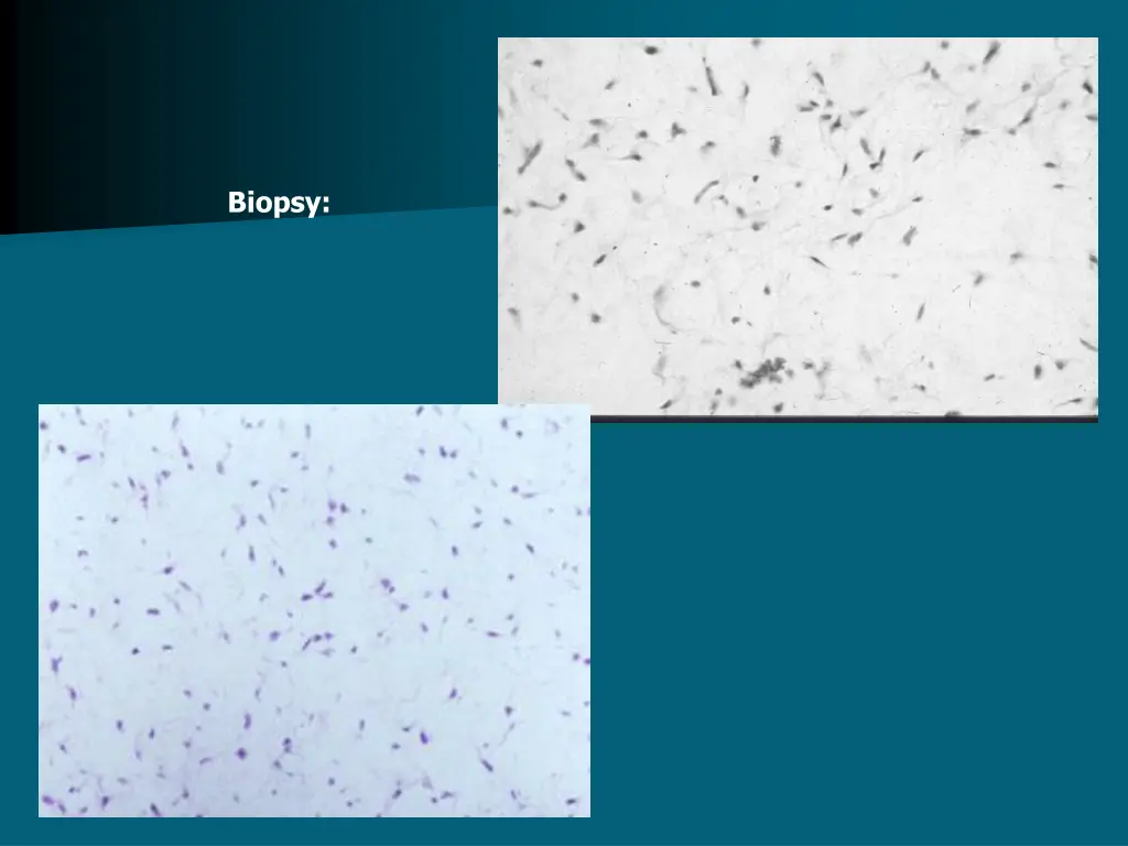 biopsy 1