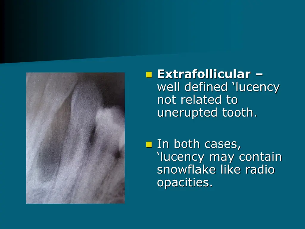 extrafollicular well defined lucency not related