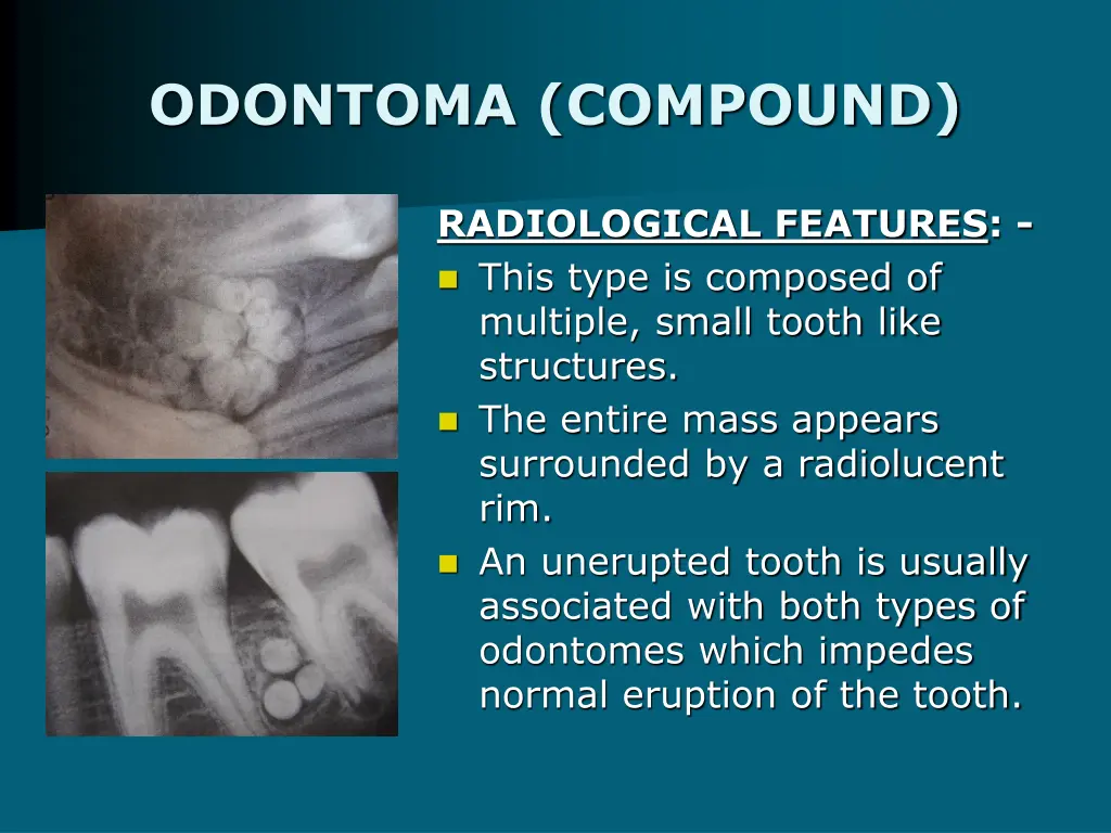 odontoma compound 1
