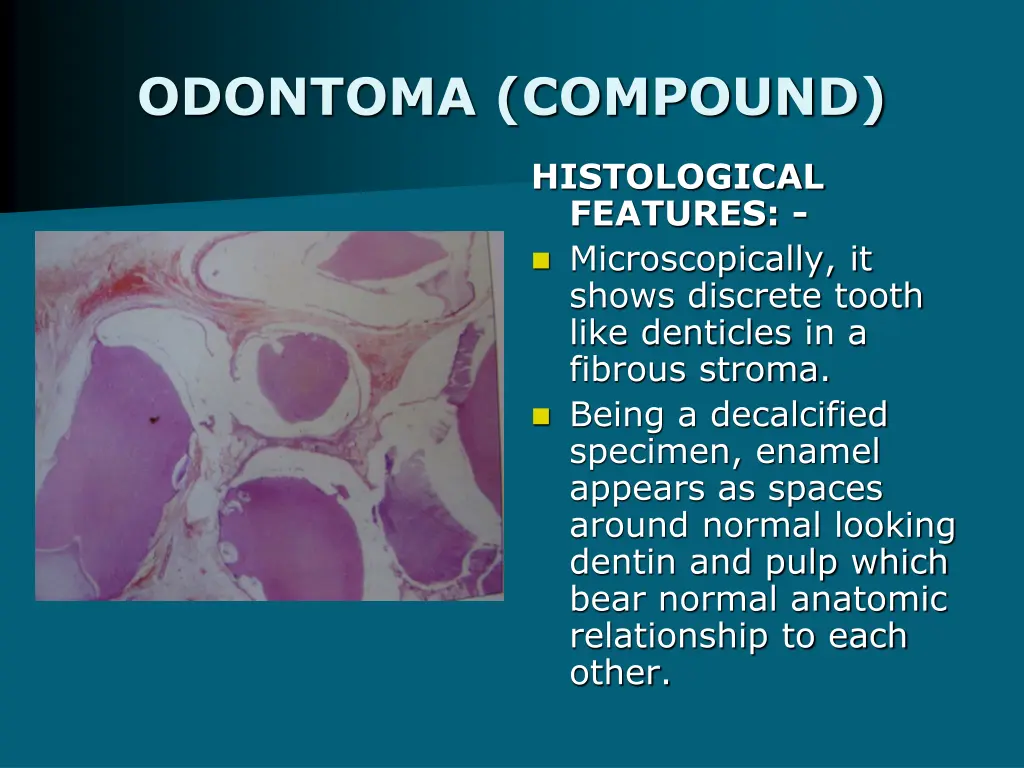 odontoma compound 2