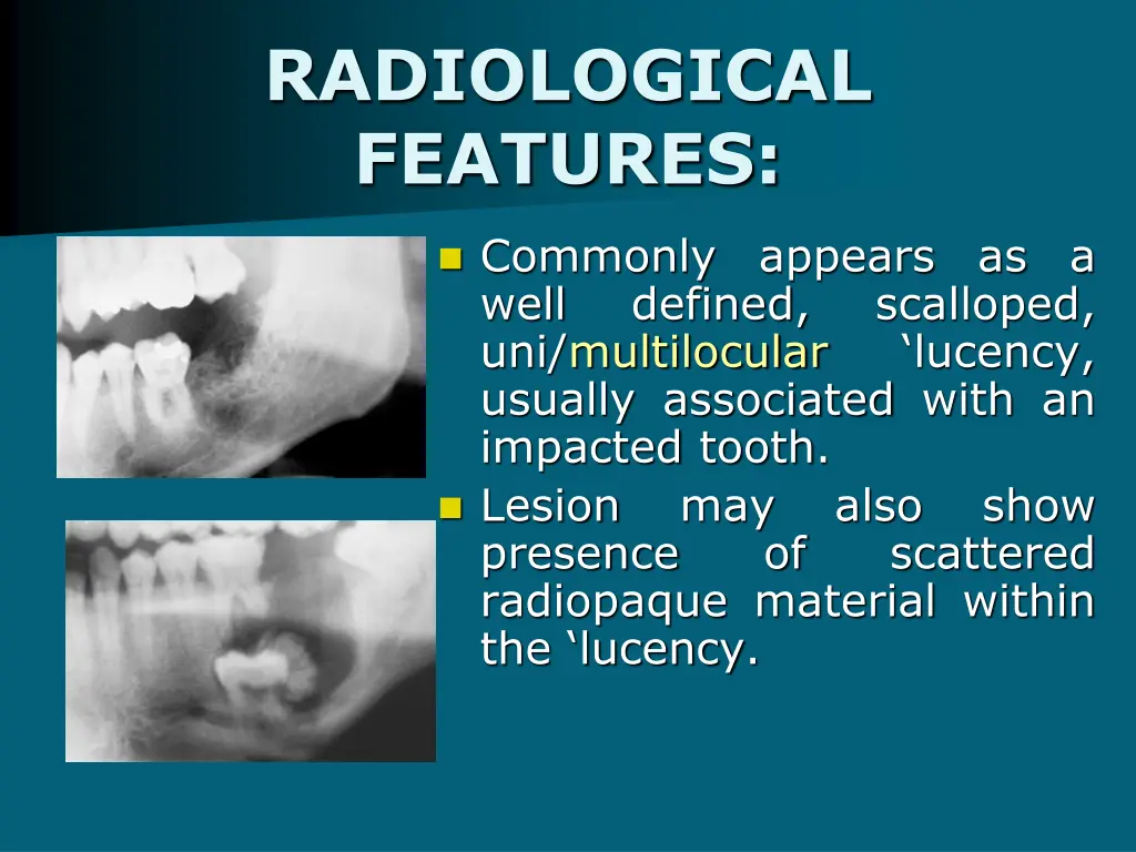 radiological features 1