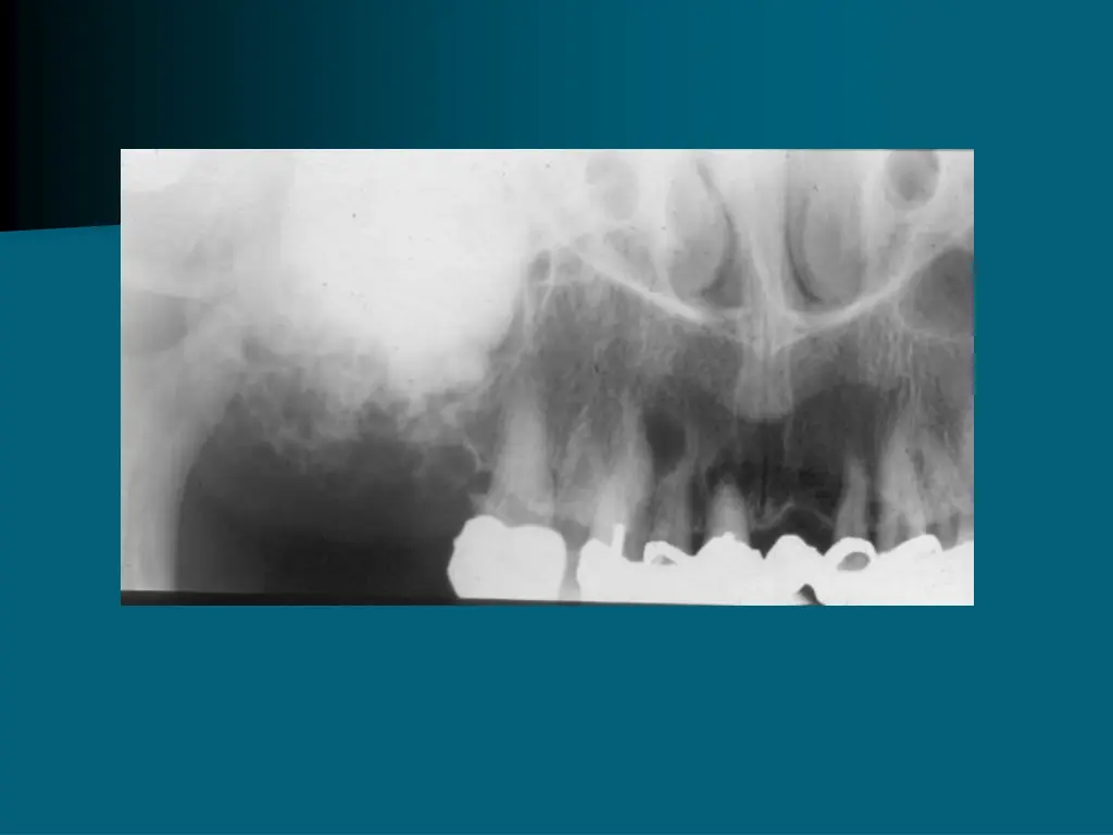 slide28