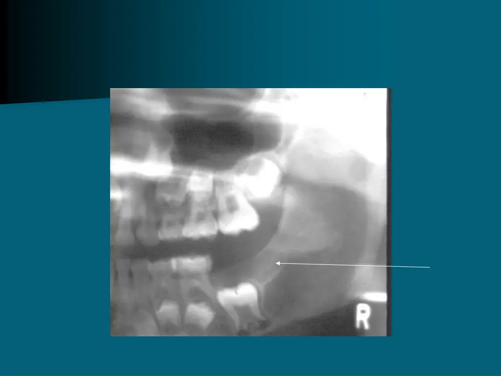 slide31