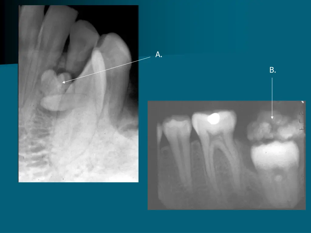 slide34