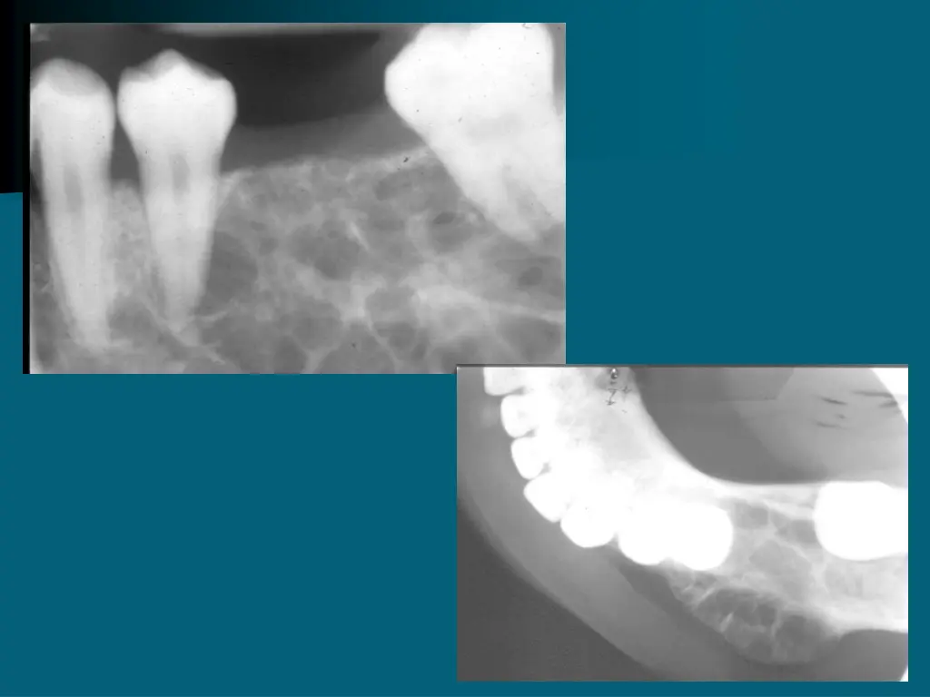 slide36