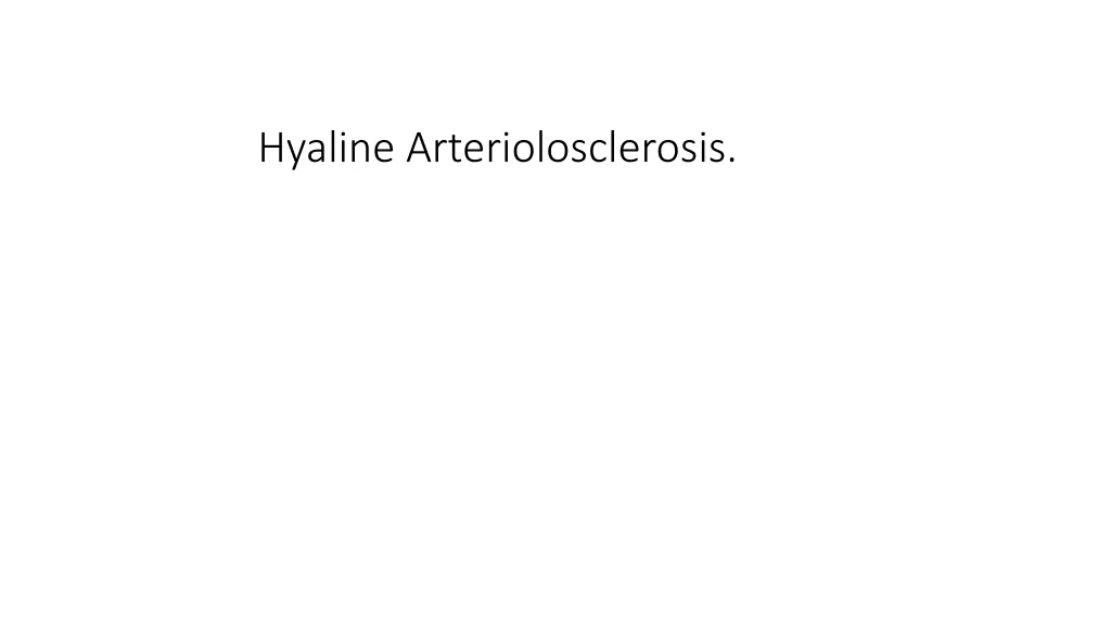 hyaline arteriolosclerosis