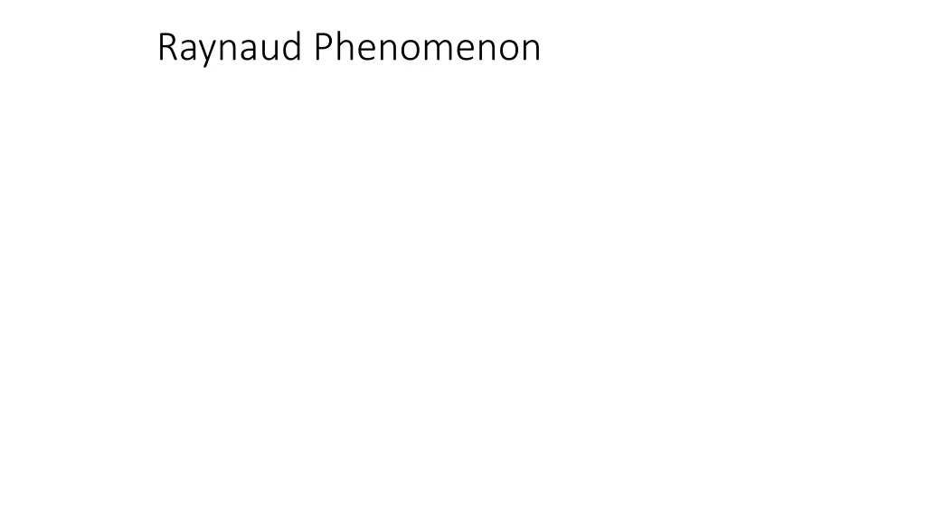 raynaud phenomenon