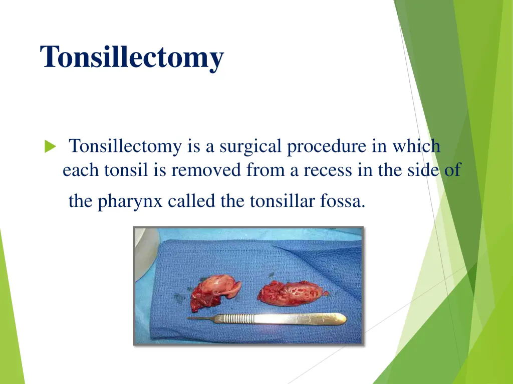tonsillectomy