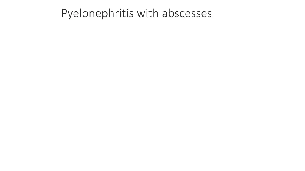 pyelonephritis with abscesses
