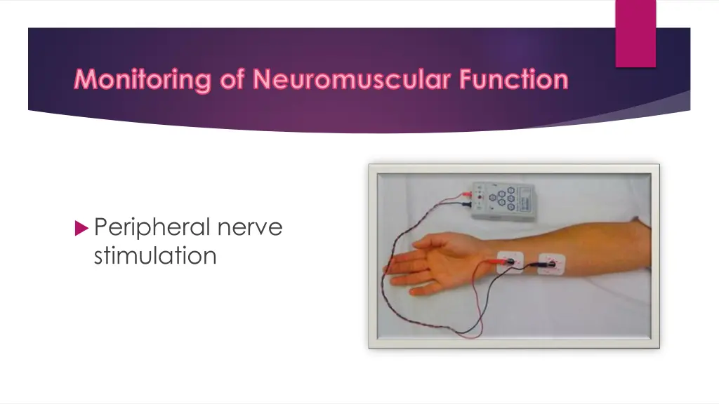 monitoring of neuromuscular function
