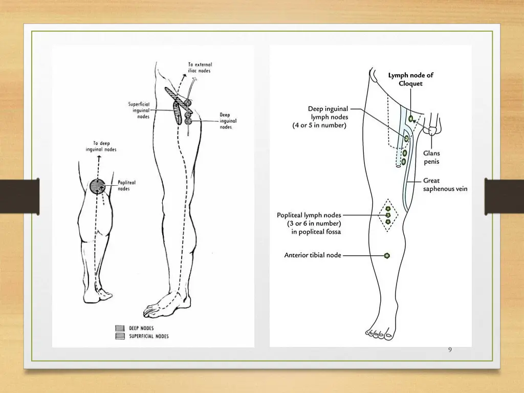 slide9