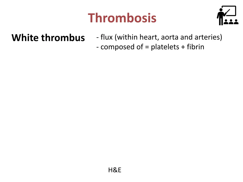 thrombosis 7