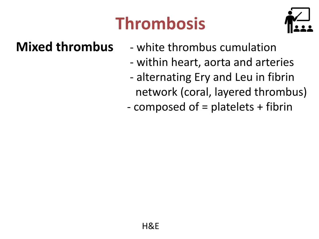 thrombosis 8