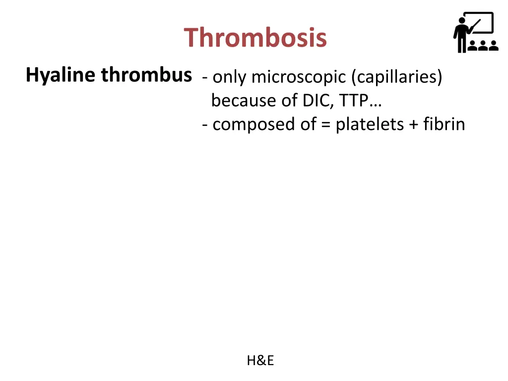 thrombosis 9