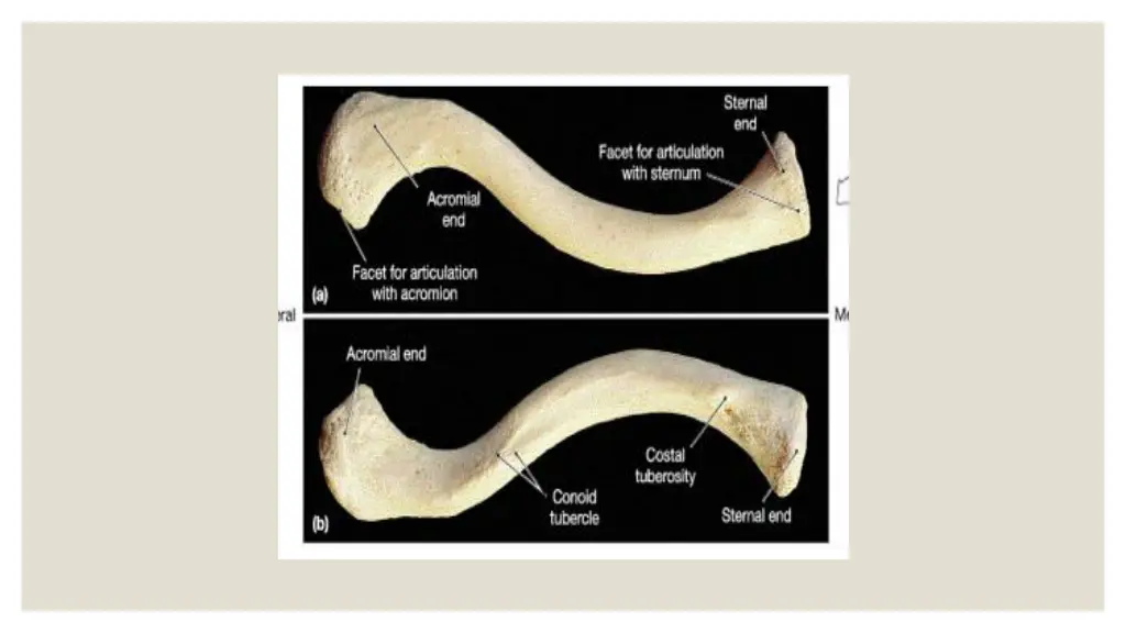 slide14