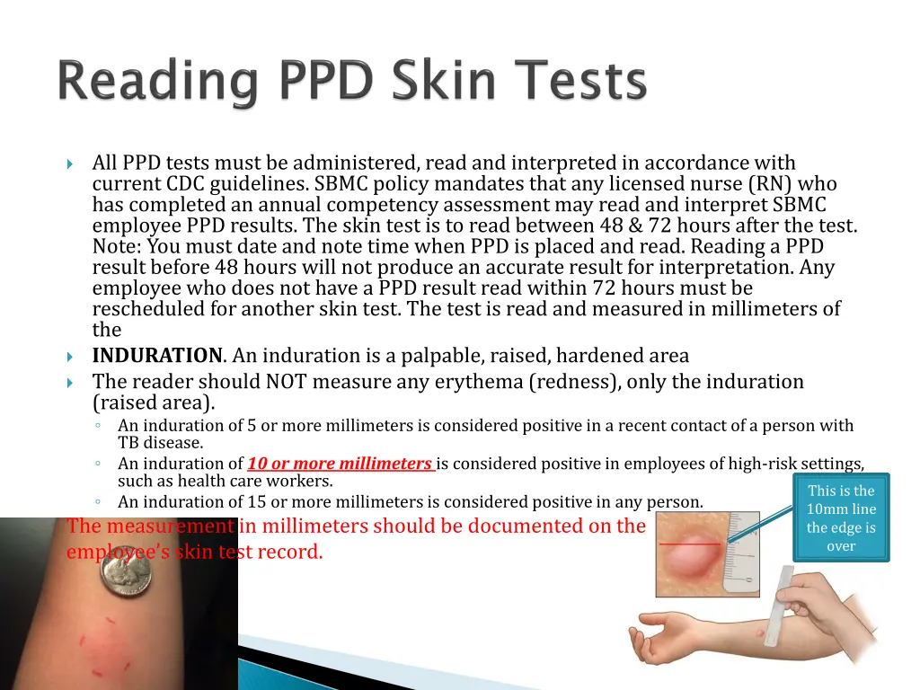 all ppd tests must be administered read