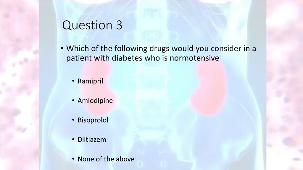 question 3