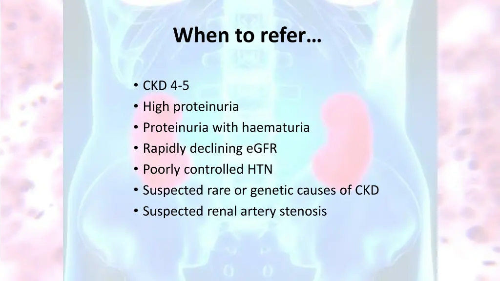 when to refer