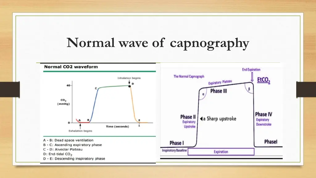 normal wave of capnography