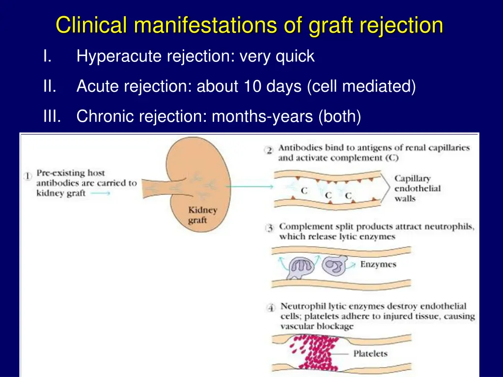 clinical manifestations of graft rejection