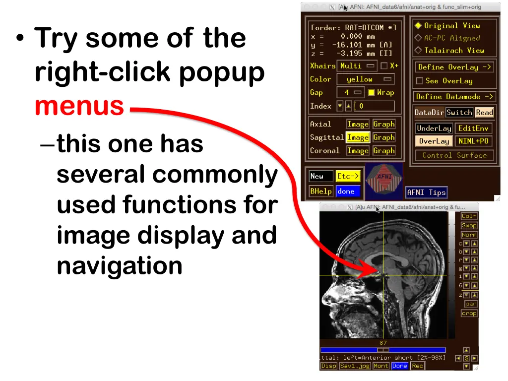 try some of the right click popup menus this 2