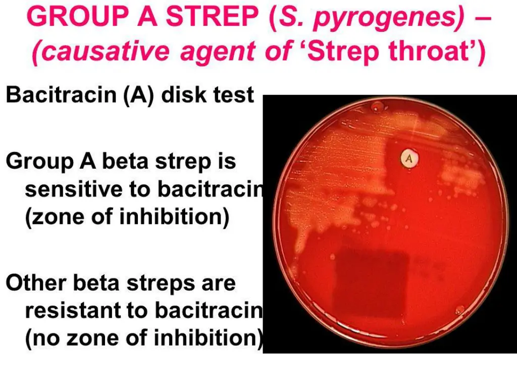 slide10