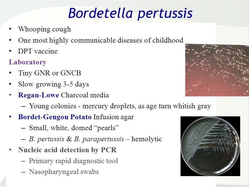 slide13
