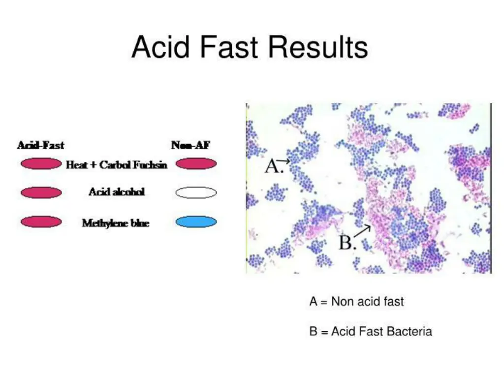 slide4