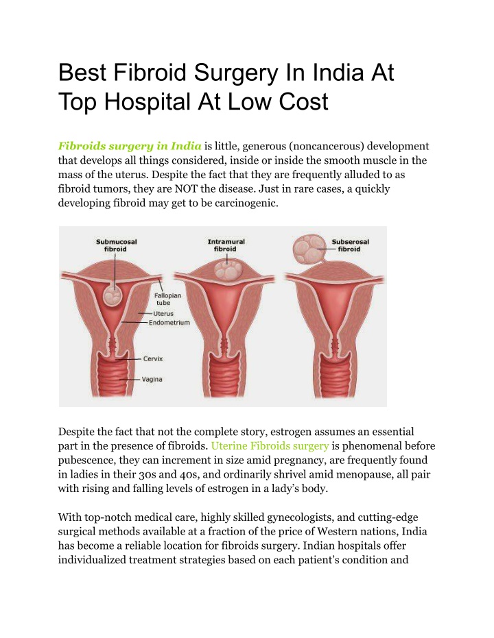 best fibroid surgery in india at top hospital