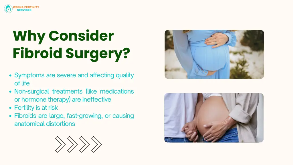 why consider fibroid surgery