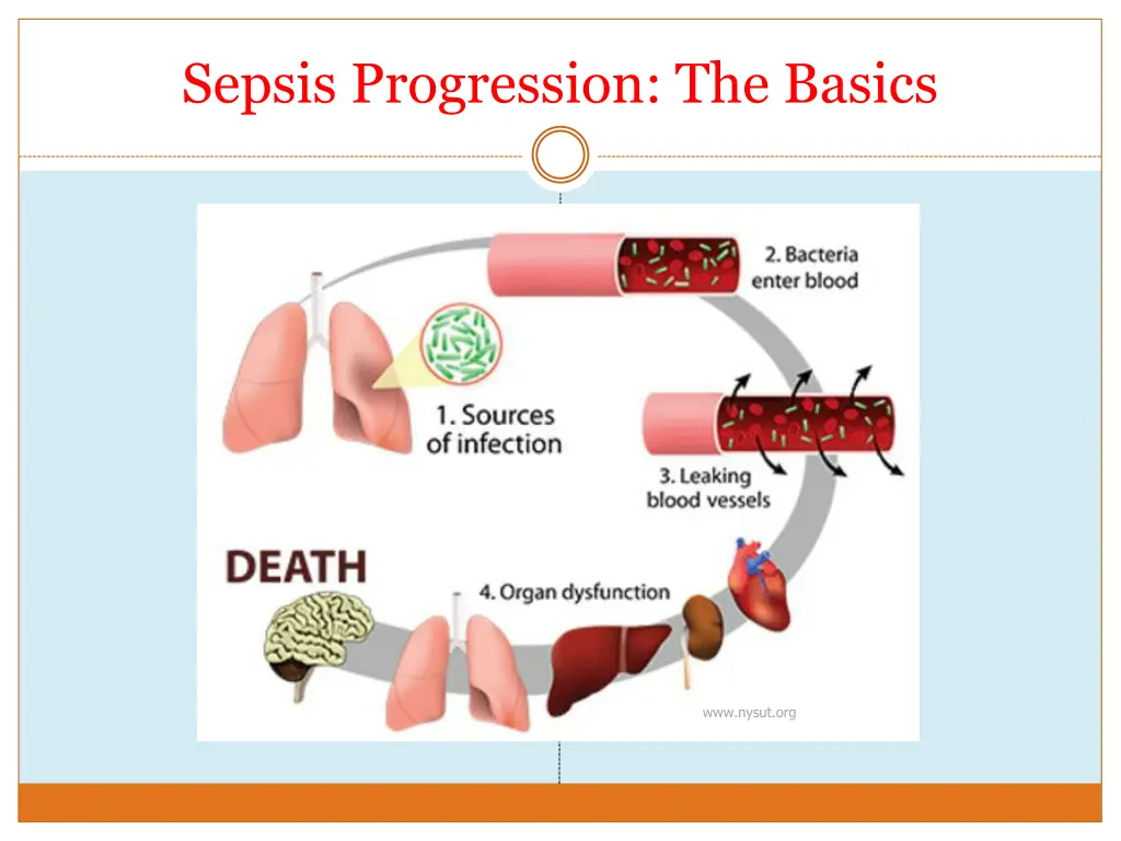 sepsis progression the basics